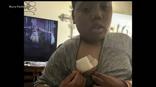 11-year-old boy speaks out after being shot by police following 911 call
