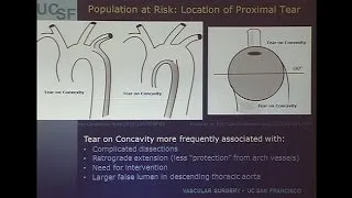 Which Acute Type B Dissection Patients Should Undergo TEVAR