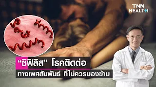 "ซิฟิลิส" โรคติดต่อทางเพศสัมพันธ์ ที่ไม่ควรมองข้าม : Daily Health