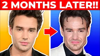 Plastic Surgeon Reacts to LIAM PAYNE'S Cosmetic Surgery Transformation