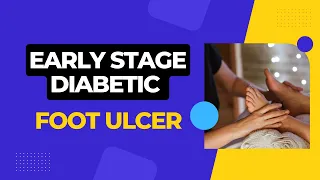 Early Stage Diabetic Foot Ulcer: Causes, Symptoms, Treatment, and Prevention Tips