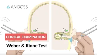 Weber and Rinne Test - Clinical Examination