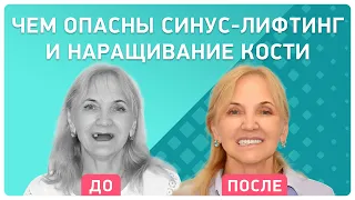 Опасные последствия синус-лифтинга и наращивания костной ткани 👉 Откровенный отзыв пациента-врача