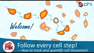 Live Cell Imaging Webinar | How to track and quantify cell movement