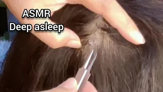 Asmr Sis Will Help You Check Your Scalp And Remove Dandruff | Deeply Relaxing | No Talking#asmr😪😴