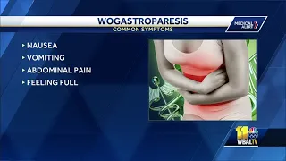 Woman's Doctor: Wogastroparesis