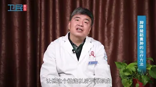 【普通外科】脚踝腱鞘囊肿的治疗方法？