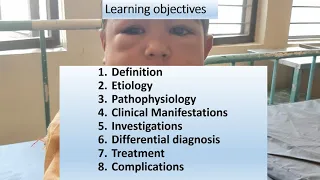 Nephrotic Syndrome | Pediatrics