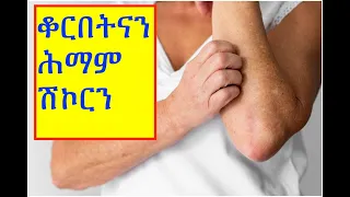 ቆርበትናን ሕማም ሽኮርን (Skin Manifestations of Diabetes)#ትግርኛ #ጥዕና #ሓበሻ