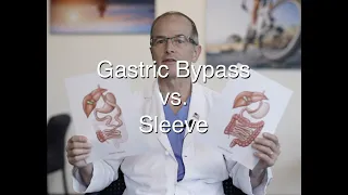 Gastric Bypass vs  Sleeve, update for 2021