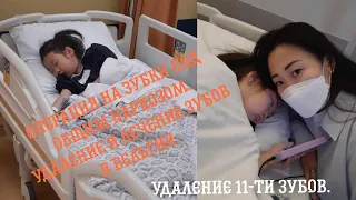 Лечение зубов ребенку под общим наркозом в Бельгии. Удаление и пломбирование зубов.