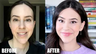 I Got Plastic Surgery in Korea || 18 Months Post Op Double Jaw Surgery