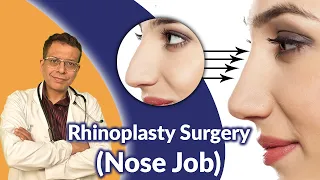 Cosmetic & Aesthetic Rhinoplasty Surgery (Nose Job) in Delhi for Reshape Your Nose Dr Sandeep Bhasin