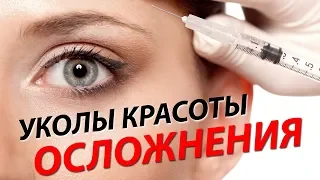 ПОСЛЕДСТВИЯ И ОСЛОЖНЕНИЯ ПОСЛЕ ИНЪЕКЦИЙ КРАСОТЫ. Елена Каркукли фейсфитнес омоложение без уколов