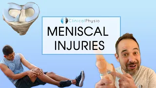 Meniscal injuries and Meniscus Tears | Expert Review on Assessment and Treatment