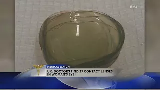 Surgeon finds 27 contact lenses in woman’s eye