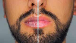 El Mejor Truco Para Hidratar Los Labios Resecos Y Agrietados