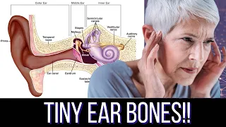 What You Need to Know About Ear Bones (Otosclerosis 101)