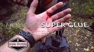 How to Super Glue a Laceration - Casual Preppers