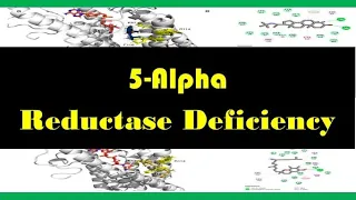 5 Alpha Reductase Deficiency