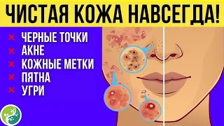 7 Простых Способов Избавиться От Прыщей! (Естественным Путем)