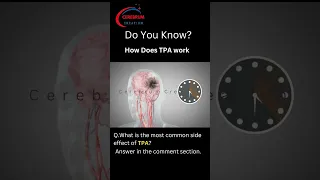 How tPA is used to treat Ischemic Stroke | tPA | Ischemic Stroke | #shorts