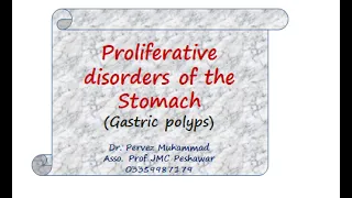 Gastric polyps by dr pevez