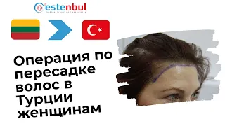 Операция по пересадке волос в Турции женщинам | Estenbul Health