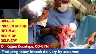 Fetal breech presentation in first pregnancy. Why is cesarean usually necessary for a safe delivery?