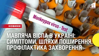 Мавпяча віспа ВЖЕ в Україні: симптоми, шляхи поширення, профілактика захворення