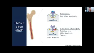 A Conversation with an MPN Specialist: Blood Count Targets in PV