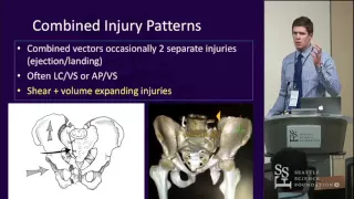 Pelvic Ring Surgical Injuries - Conor Kweleno, MD & Michael Githens, MD