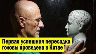 Первая успешная пересадка головы человека проведена в Китае