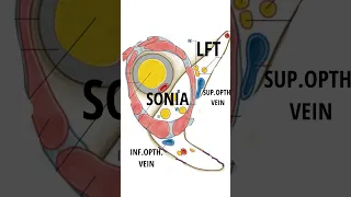 Contents Of Superior Orbital Fissure | Anatomy | MNEMONIC #shorts #short