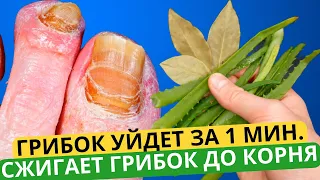 Эта ЯДРЕНАЯ Мазь, Съедает Ногтевой Грибок До Самого Корня! Есть в Любой Аптеке..