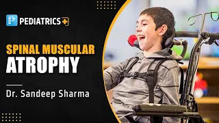 Spinal Muscular Atrophy by Dr. Sandeep Sharma | PrepLadder Pediatrics NEET SS