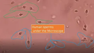 Human sperms under the Microscope