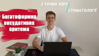 Багатоформна ексудативна еритема. Підготовка до КРОК 2.