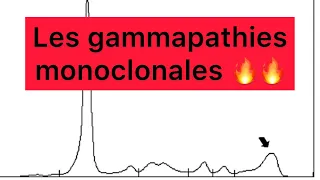 📍Les Gammapathies Monoclonales 🔥🔥 | khadidja ferdj 🔥