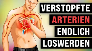 TOP Lebensmittel zur Reinigung deiner ARTERIEN!!