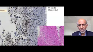 Science of COVID-19: "Neurological Complications of Coronaviruses"