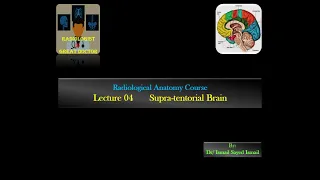 Radiological Anatomy Course -Lecture 04 -Brain Supra-tentorial Part(2)