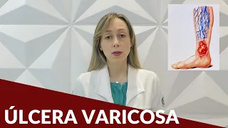 Úlcera varicosa - Dra. Nayara Cioffi Batagini - Cirurgia Vascular e Endovascular
