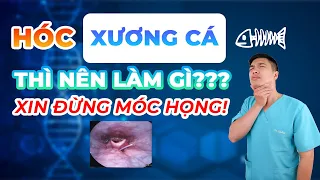 HÓC XƯƠNG CÁ THÌ LÀM GÌ - XIN ĐỪNG MÓC HỌNG - Anh Bác sĩ