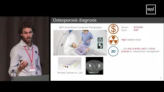 Advanced analysis of bone health for osteoporosis management