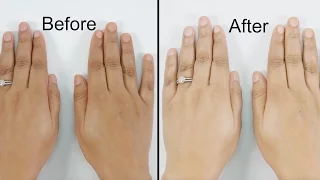 Get Fairer, Soft & Wrinkle Free Hands and Feet At Home in 15 Minutes