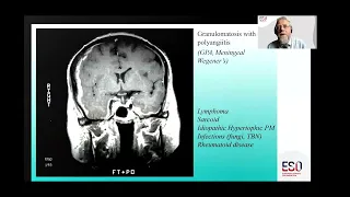 ESO Guideline Webinar on PACNS & SVD Part 2