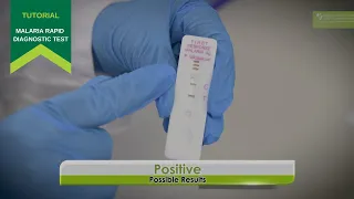 How to use a Malaria Rapid Diagnostic Test