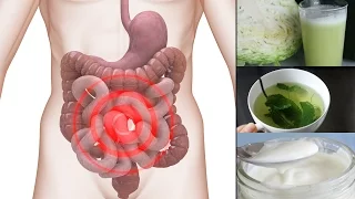Natural Remedies for Ibs (Irritable Bowel Syndrome)