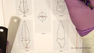 Drawing Permanent Maxillary Right Canine